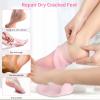Aluroice 2 Pairs Silicone Moisturizing Socks for Dry Cracked Feet Women, Soft Gel Pedicure Foot Spa Aloe Socks, Anti-Slip Moisturizer Socks for Dry Cracked Feet Overnight Foot Care Pink&White view 4