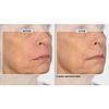 Signature Club A 5 Essentials Creme for Face and Eyes with Plant Stem Cell Complex view 4