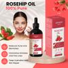 AEKONIK Rosehip Oil for Acne & Wrinkle Reduction - Natural Anti Aging Serum with Organic Essential Oil - Face Moisturizer Skin Care Oil - Effective & Versatile Beauty Serum | 4fl oz (118 ml) view 2