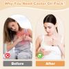 Castor Oil Pack for Breast, 4 PCS Reusable Organic Castor Oil Pack Wrap,Soft Breast Pads for Relaxing Sleeping (Oil Not Included) - White+Khaki view 2