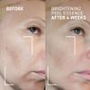 Dr. Brandt Dr. B Lab Brightening Peel Essence - Evens Skin Tone, Smooths Skin Texture & Improves Radiance - 3.4 fl oz view 3