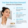 Chemical Peel for Face Gentle AHA BHA Exfoliant with Fruit Enzymes view 3