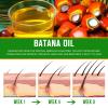 Batana Hair Growth Oil - 60ml Organic Formula for Strengthening, Thickening, Repairing Damaged Hair, Nourishing Scalp - 100% Natural for Women and Men view 4