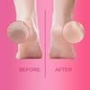 CUTIKLES CUTIKLES Professional Callus Remover Gel for Feet  Extra Strength Gel Instantly Removes Tough Calluses for Spa-Quality Pedicures at Home. Convenient Travel-Friendly Pack - 1 Fl Oz view 2