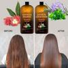 Castor Oil Shampoo and Conditioner - An Anti Hair Loss Set Thickening formula For Hair Regrowth, Anti Thinning Sulfate Free For Men & Women Anti Dandruff Treatment - 16 oz view 2