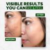 Loriini Multi Peptide Face Serum, Hydrating Collagen Boosting Serum view 4