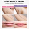 IPL Laser Hair Removal Device Permanent for Women & Men, 999,999 Flashes Safe Effective Lasting Hair Remover, Alternative to Salon, for Face Arms Armpit Legs Bikini Area Whole Body Home Treatment view 3