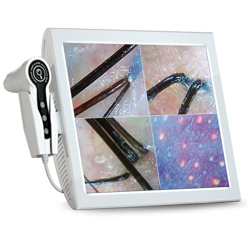 KEULEN 15 Inch Skin Hair Scalp Detector, 50X/200X Skin Hair Analyzer, Four Pictures Comparison and Picture Storage Function, for Beauty Salons, Hair Salons, Skin Management Centers, Shopping Mall
