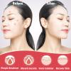 450 Pimple Patches for Face, Hydrocolloid Acne Patches for Zit Covers, Mighty Patch Acne Invisible Zit Patches for Face, 4 Sizes view 2