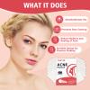 450 Pimple Patches for Face, Hydrocolloid Acne Patches for Zit Covers, Mighty Patch Acne Invisible Zit Patches for Face, 4 Sizes view 3