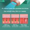 IPL Hair Removal,Laser Hair Removal At-Home for Women Men, 999,999 Flashes Permanent Hair Removal Device on Facial Legs Arms Bikini Line view 2