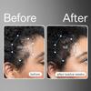 Act+Acre 3-Pack Mini Cold Processed Stem Cell Scalp Serum - Promotes Thicker, Fuller-Looking Hair - Soothes and Hydrates - Sulphate and Paraben Free - Aloe Vera for Improved Scalp Health view 2