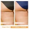 Anti Cellulite Cream for Butt and Thighs, Body Firming Cream with 4% Caffeine and Forskolin, B Flat Belly Firming Cream and Skin Tightening Cream, Moisturizing 5.4 oz view 4