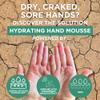 Footlogix Hydrating Hand Mousse with Dermal Infusion Technology | Deep Hydration for Dry Hands | Urea-Enriched Formula | Fast-Absorbing | 4.23 ozl/119.9 g/125 ml view 3