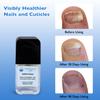 NailPlex Shield Nail Stregthener for Damaged Nails Nail Repair Advanced Formula Cuticle Serum Treatment 0.5 Fl Oz view 3
