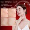 Betgod Led Red Light Therapy for Face, 7 Color Facial Mask Blue Red for Face Facial Skin Care(White) view 4