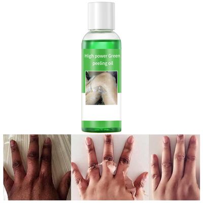 Peeling Oil for Dark Skin, Green Peeling Oil, Facial Peels with Hyaluronate,Exfoliating Peel Solution for Body, Chemical Peel At Home for Dark Spots, Body Exfoliant Peels 3.66 OZ