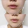 40 Pieces Face Lift Tape Set Invisible For Stickers Fast Lifting Thin Double Chin V Facelifting Pat Face Lift Tape For Eyes view 4