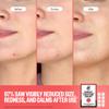 PEACE OUT Early Stage Acne Dots Helps Target Blemishes Below the Surface, Hydrocolloid Pimple Patches Minimize Bumps Before They Appear with Dissolving Microneedles, Salicylic Acid, 8 Count view 4