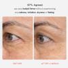 First Aid Beauty - Retinol Eye Cream with Squalane + Ceramides, Encapsulated Retinol Serum for Delicate Skin, Helps Improve Appearance of Fine Lines and Wrinkles, Safe for Sensitive Skin, 0.5 oz view 2