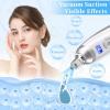 Beauty Star Upgraded Cordless Diamond Micro-dermabrasion Machine, Portable Crystal Tips Tool for Facial Skin Care, Face Pore Vacuum Glow Devices Kit, Home Use Microderm Equipment view 4