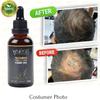 WYESS Natural Argan Oil Serum for Men's Hair Growth, Stimulating and Easy to Use view 3
