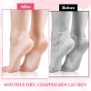 3 Pairs Moisturizing Socks Overnight, Spa Socks for Dry Feet, Cotton Moisture Enhancing Socks, Lotion Socks for Cracked Heel Repair, Cosmetic Moisturizing Socks for Women White view 4