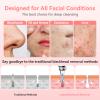 Blackhead Remover Pore Vacuum Upgraded Facial Pore Cleaner Electric Comedone Whitehead Extractor Tool-5 Suction Power,5 Probes,USB Rechargeable Blackhead Vacuum Kit for Women & Men view 4