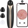 KouRy Blackhead Remover,Vacuum Pore Cleaner with Camera,Facial Cleaner WiFi USB Rechargeable Acne Extractor with 3 Probes Beauty Device for Skin Shrink pores view 2
