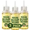 BodyJ4You Piercing Keloid Bump Removal - Natural Oil Piercing Bump Treatment - Nose Septum Belly Ear Cleaner Soothing Skin Recovery Solution - Safe Care New Piercing Reduce Scars - 3 x 0.33 Fl Oz view 1