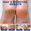SKIN ULTIMA Urea Cream 40 Percent Plus 2% Salicylic Acid, 40% Urea Cream for Feet Maximum Strength, Foot Cream for Dry Cracked Feet, Heels, Knees, Hands & Elbows, Intensive Repair & Moisture, 5.29 oz view 3