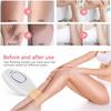 Home Use Beauty Device IPL Laser Hair Removal for Women and Men,999999 Flashes at-Home Laser Hair Removal Device view 3