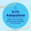 Differin Acne Treatment Gel and Differin Patch Set: 36 Power Patches, 18 large and 18 small patches for acne-prone skin and A30 day retinoid treatment with 0.1% Adapalene pump, Mother's Day Gifts view 4