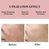 5 in 1 Age Defense Cream Collagen, Vitamin E, C and Nicotinamide Vitamin B Anti Aging Facial Cream - Restoring, Smoothing & Hydrating - Reduces Fine Lines, Wrinkles, Dehydrated Skin & More. view 3