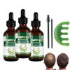 Aceite de Romero Para, Aceite de Romero Para el Crecimiento Del Cabello, Aceite de Ricino para Cejas y Pestaas y Cuidado de la Piel 6.0 FI OZ/180ML view 1