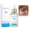 LA.PERSONAL Eye Serum, Eye Relief Serum for Reducing Irritation, Moisturizing 1.01 Fl oz/30 Ml view 1