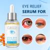 LA.PERSONAL Eye Serum, Eye Relief Serum for Reducing Irritation, Moisturizing 1.01 Fl oz/30 Ml view 4