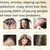 2 Box Ginger Plant Extract Shampoo for Hair Growth and Anti-Loss Control, Hair Growth Oil Care by Ginaday view 3