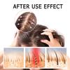 2 Box Ginger Plant Extract Shampoo for Hair Growth and Anti-Loss Control, Hair Growth Oil Care by Ginaday view 4