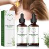 Shelure Extreme Hair Growth and Regrowth Oil - Best Hair Oil for Luscious Locks (2pcs) view 1