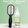 Dr. Entre's Callus Remover Gel & Foot File: Extra Strength Callus Remover for Feet, Foot Callus Remover Care, Pedicure Tools Supplies, Spa Kit, Dead Skin Scrubber, 4 oz view 4