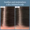 Briogeo Scalp Revival Rosemary Pre-Wash Oil - Moisturizing Scalp Treatment for Dry, Flaky, or Itchy Scalp, Strengthens Hair & Soothes Scalp, Vegan & Cruelty-Free, 3.4 oz view 2