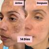 NinthAvenue Basics Tonico Despigmentante LB *Elimina pecas, barros, paos, melasma* view 2