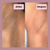 NinthAvenue Basics Tonico Despigmentante LB *Elimina pecas, barros, paos, melasma* view 3