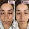 NinthAvenue Basics Tonico Despigmentante LB *Elimina pecas, barros, paos, melasma* view 4