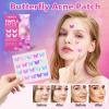 Acne Pimple Patches for Face (160 Counts), Hydrocolloid Acne Patches with Tea Tree Oil and Calendula Extract, Cute Colorful Butterfly Shape Spot Stickers for Skin Care, Zit Patches view 3