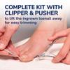 Dr. Scholl's INGROWN TOENAIL PAIN RELIEVER & TRIMMING KIT, 0.3 oz // Only OTC Treatment Proven to Relieve Ingrown Toenail Pain - Includes Medicated Gel + Foam Rings + Bandages + Clipper & Pusher Tools view 4