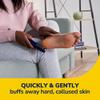 Dr. Scholl's Callus Remover Electronic Foot File, Electric Hard Skin Removal for Feet, Effortless Soft Smooth Skin in Minutes, Perfect for Travel, for Women & Men, AAA Batteries Included view 2