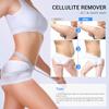 MEIQIER sens for Improvement in The Appearance of Cellulite Device Cellulite Massager Radio Frequency, White view 2