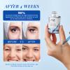 ANAI RUI Bakuchiol Blue Tansy Night-Repair Facial Oil Natural Retinol Alternative + Squalane Jojoba, for Deep Wrinkles & Fine Lines Soothing,Calm & Soothe Redness,Hydrating, Balancing, 1 FL.OZ view 4